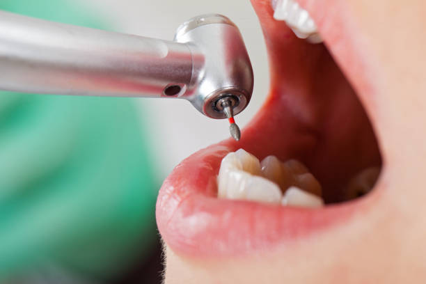 Best Urgent Dental Care for Toothache in Laurel, MD